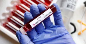 Sample Specimen CA19 Blood test PCR COVID 