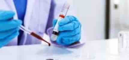 Syphilis Blood Test Home Kit 