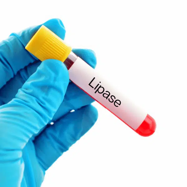 A-Lipase-test - Product ID: 113133