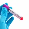 A-Anaemia blood test profile uk - Product ID: 118324