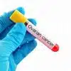 A-CA125-ovarian-cancer-test-kit - Product ID: 125925