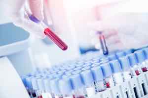 Immuno Blood Levels: What is It?
