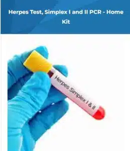Herpes Test is Essential