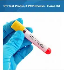 STI Test uses