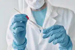 STD, STI, HPV, Syphilis test, screening