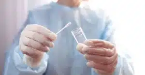 STD, STI, HPV, Syphilis Test Mycoplasma Ureaplasma
