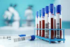 CBC, FBC, complete blood count test, general analysis