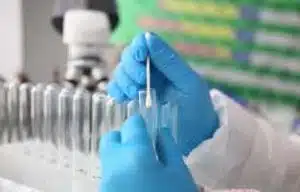 HPV test lab