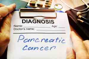 pancreatic cancer, CA19-9 blood test tumour markers