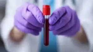 cbc, fbc, complete blood count, full blood count test